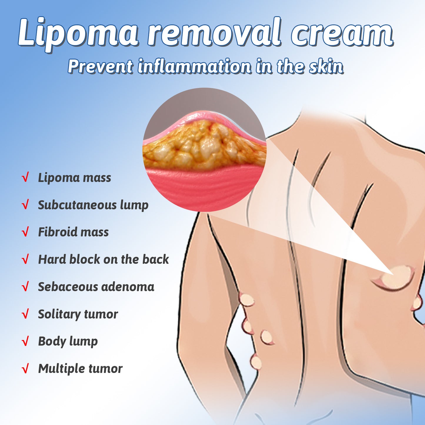 🧴NUEVO SPRAY LIPOCONTROL™ - El método natural para reducir lipomas sin cirugía ni dolor