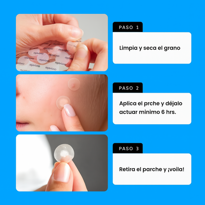 🧴 KORMESIC SKIN PATCH – Reparación invisible para tu piel✨