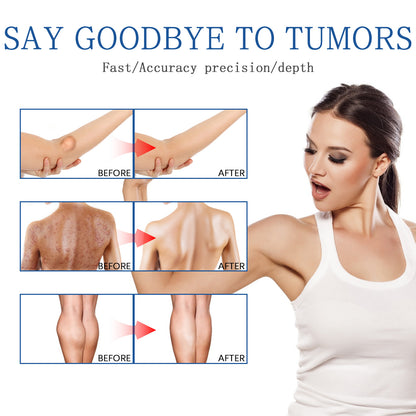 🧴NUEVO SPRAY  LIPOCONTROL™  - El método natural para reducir lipomas sin cirugía ni dolor